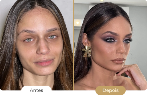 Img antes e depois 01