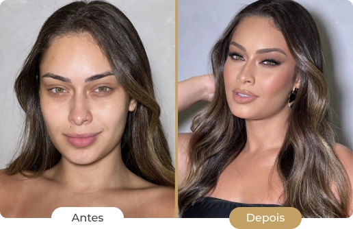 Img antes e depois 02